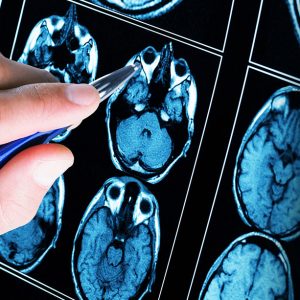 Κύριες μελέτες τεκμηρίωσης αποτελεσματικότητας