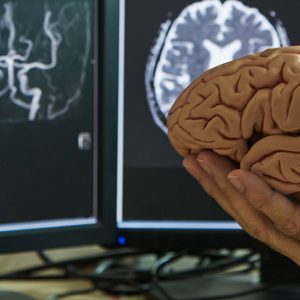 Πότε είναι ο κατάλληλος χρόνος για νευροδιεγέρτη DBS